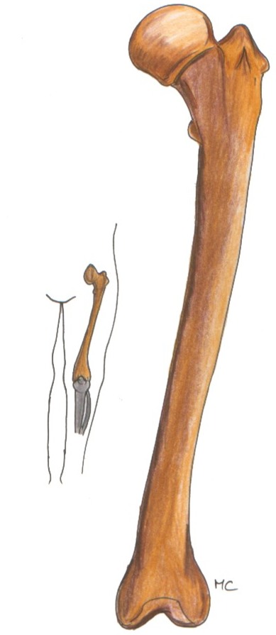 femur