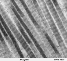 Collagen_Type_I_-_TEM